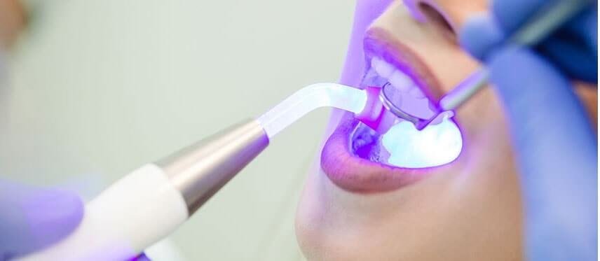 GPA Dental Group Clinic Restoration Dentistry Services in Singapore dental - gpa dental group restoration dentistry slider - GPA Dental Group | Dental Clinic Singapore